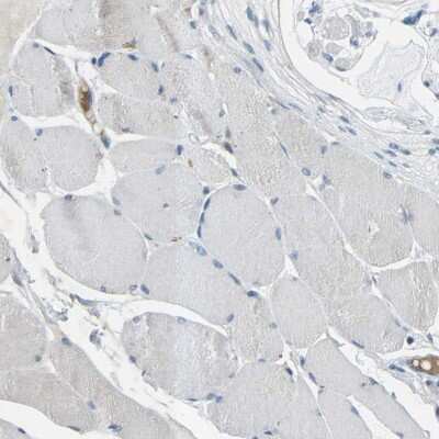 Immunohistochemistry-Paraffin: p120-catenin Antibody [NBP2-38130]