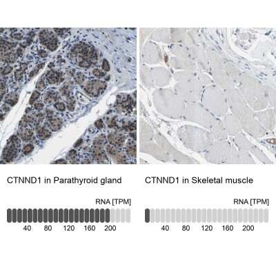 Immunohistochemistry-Paraffin: p120-catenin Antibody [NBP2-38130]