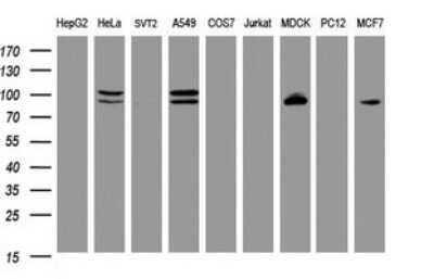 Western Blot: p120-catenin Antibody (OTI2E8)Azide and BSA Free [NBP2-73179]