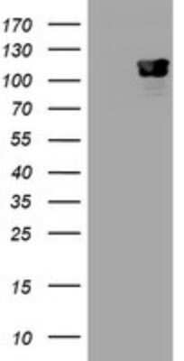 Western Blot: p120-catenin Antibody (OTI2E8)Azide and BSA Free [NBP2-73179]
