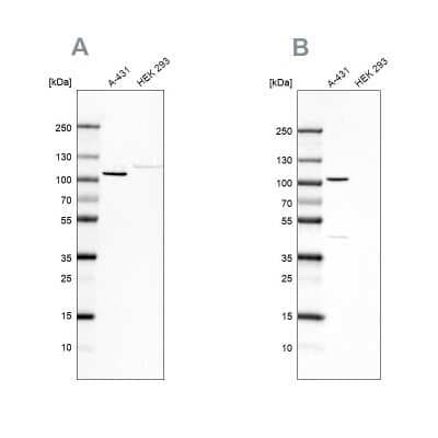Western Blot: p120-catenin Antibody [NBP1-85383]