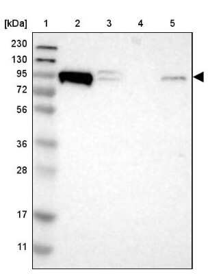 Western Blot: p120-catenin Antibody [NBP2-38130]