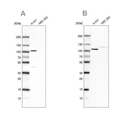 Western Blot: p120-catenin Antibody [NBP2-38130]