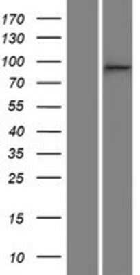 Western Blot: p120-catenin Overexpression Lysate [NBP2-10651]