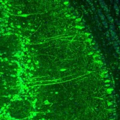 Immunohistochemistry: p130Cas/BCAR1 Antibody [NBP2-34076]
