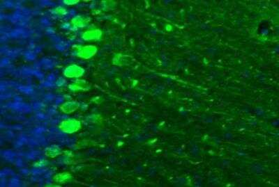 Immunohistochemistry: p130Cas/BCAR1 Antibody [NBP2-34076]