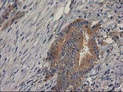 Immunohistochemistry: p130Cas/BCAR1 Antibody (OTI1A9) - Azide and BSA Free [NBP2-73181]