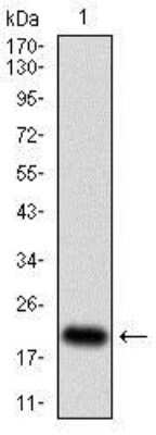 Western Blot Detection of Recombinant p16INK4a/CDKN2A