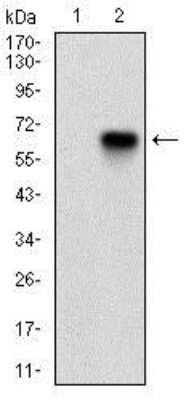 Western Blot Analysis of p16INK4a/CDKN2A in HEK293 Cell Lysates