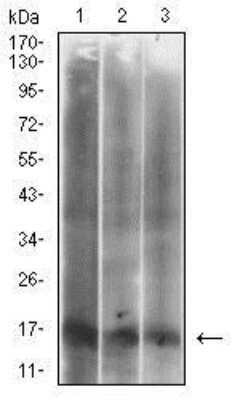 Western Blot Analysis of p16INK4a/CDKN2A in Multiple Cell Lysates