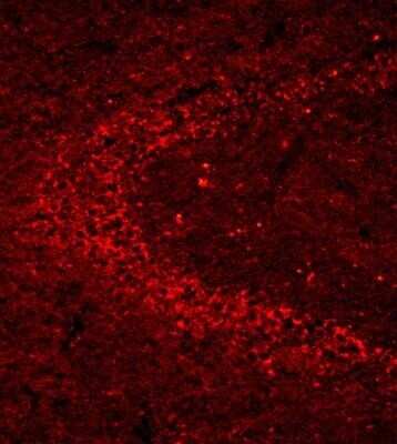 Immunohistochemistry-Frozen: p14ARF/CDKN2A Antibody - BSA Free [NB200-111]