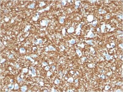 Immunohistochemistry-Paraffin: p14ARF/CDKN2A Antibody (4C6/4) - Azide and BSA Free [NBP3-08233]