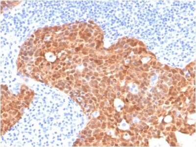 Immunohistochemistry-Paraffin: p16INK4a/CDKN2A Antibody (CDKN2A/4499) [NBP3-07384]