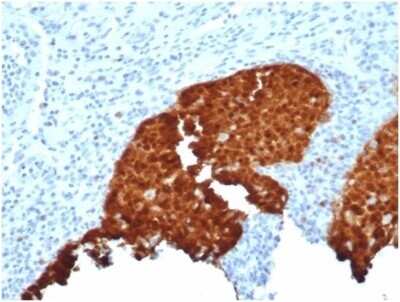 Immunohistochemistry-Paraffin: p16INK4a/CDKN2A Antibody (CDKN2A/4844R) [NBP3-13833]