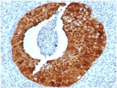 Immunohistochemistry-Paraffin: p16INK4a/CDKN2A Antibody (CDKN2A/4844R) [NBP3-13833]