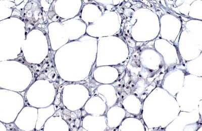 Immunohistochemistry-Paraffin: p16INK4a/CDKN2A Antibody (GT888) [NBP3-13670]