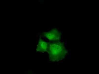 Immunocytochemistry/ Immunofluorescence: p16INK4a/CDKN2A Antibody (OTI4C11) [NBP2-45602]