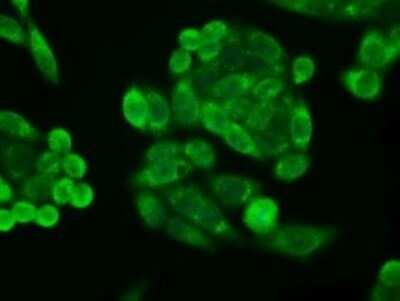 Immunocytochemistry/ Immunofluorescence: p16INK4a/CDKN2A Antibody (OTI4C11) [NBP2-45602]