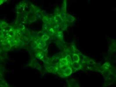 Immunocytochemistry/ Immunofluorescence: p16INK4a/CDKN2A Antibody (OTI4C11) [NBP2-45602]
