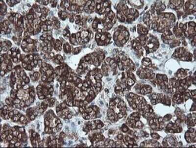 Immunohistochemistry: p16INK4a/CDKN2A Antibody (OTI4C11) [NBP2-45602]