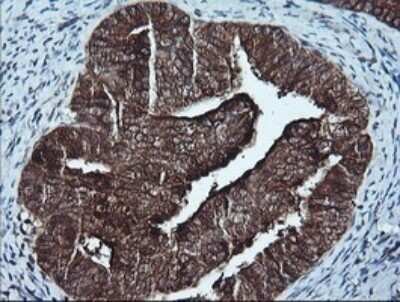 Immunohistochemistry: p16INK4a/CDKN2A Antibody (OTI4C11) [NBP2-45602]