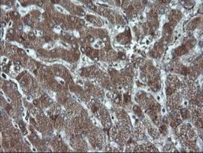 Immunohistochemistry: p16INK4a/CDKN2A Antibody (OTI4C11) [NBP2-45602]