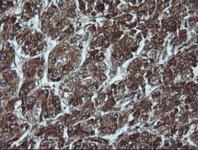 Immunohistochemistry: p16INK4a/CDKN2A Antibody (OTI4C11) [NBP2-45602]