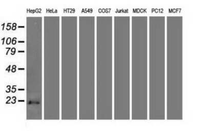 Western Blot: p16INK4a/CDKN2A Antibody (OTI4C11) [NBP2-45602]