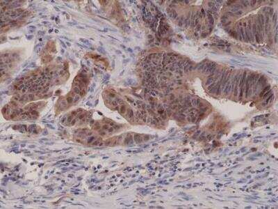 Immunohistochemistry-Paraffin: p16INK4a/CDKN2A Antibody (RM267) [NBP3-18535]