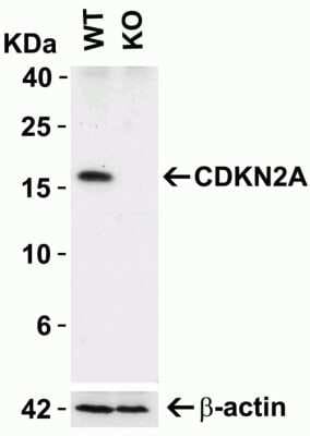 Western Blot: p16INK4a/CDKN2A AntibodyBSA Free [NBP3-06986]