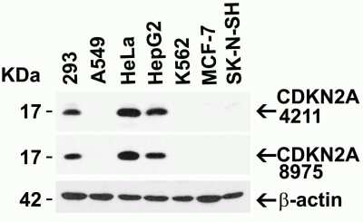 Western Blot: p16INK4a/CDKN2A AntibodyBSA Free [NBP3-06986]