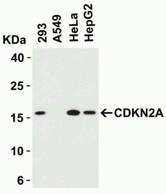 Western Blot: p16INK4a/CDKN2A AntibodyBSA Free [NBP3-06986]