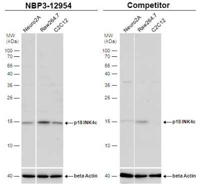 Western Blot: p18INK4c/CDKN2C Antibody [NBP3-12954]