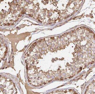 Immunohistochemistry-Paraffin: p190RhoGAP Antibody [NBP2-49172]