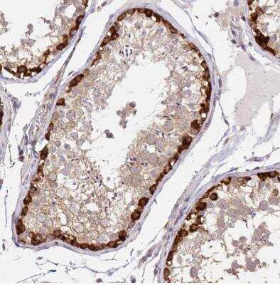 Immunohistochemistry-Paraffin: p190RhoGAP Antibody [NBP2-49229]