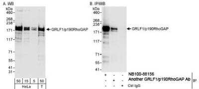 Western Blot: p190RhoGAP Antibody [NB100-88154]