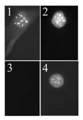 Immunocytochemistry/ Immunofluorescence: p19ARF/CDKN2A Antibody (5-C3-1) - Azide and BSA Free [NBP2-80897]