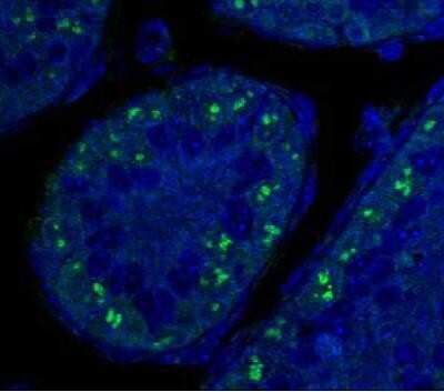 Immunohistochemistry: p19ARF/CDKN2A Antibody (5-C3-1) - Azide and BSA Free [NBP2-80897]