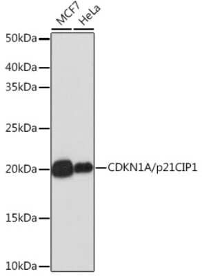 Western Blot: p21/CIP1/CDKN1A Antibody (4Z1H9) [NBP3-15661]