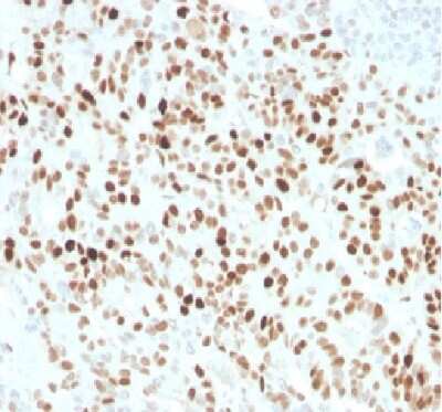 Immunohistochemistry-Paraffin: p21/CIP1/CDKN1A Antibody (CIP1/4377R) [NBP3-07215]