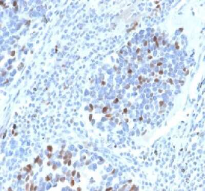 Immunohistochemistry-Paraffin: p21/CIP1/CDKN1A Antibody (CIP1/4377R) [NBP3-07215]