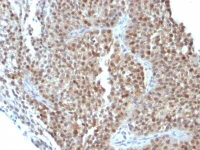 Immunohistochemistry-Paraffin: p21/CIP1/CDKN1A Antibody (CIP1/823 + DCS-60.2) - Azide and BSA Free [NBP2-47897]