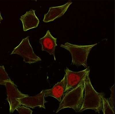 Immunocytochemistry/ Immunofluorescence: p21/CIP1/CDKN1A Antibody (CIP1/823) - Azide and BSA Free [NBP2-47783]