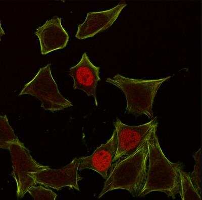 Immunocytochemistry/ Immunofluorescence: p21/CIP1/CDKN1A Antibody (CIP1/823) [NBP2-44527]