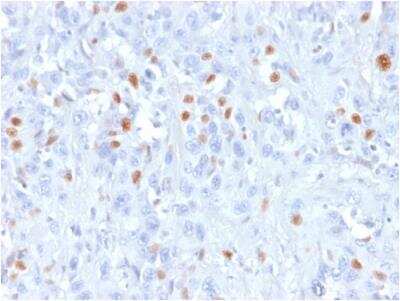 Immunohistochemistry-Paraffin: p21/CIP1/CDKN1A Antibody (rCIP1/823) - Azide and BSA Free [NBP3-09174]