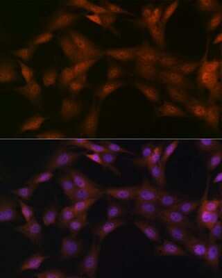 Immunocytochemistry/ Immunofluorescence: p23/PTGES3 Antibody (10M9W8) [NBP3-16586]