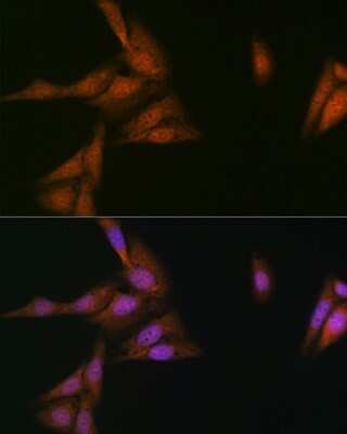 Immunocytochemistry/ Immunofluorescence: p23/PTGES3 Antibody (10M9W8) [NBP3-16586]