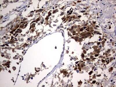 Immunohistochemistry: p23/PTGES3 Antibody (OTI2D2) [NBP2-45457]