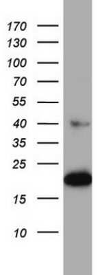 Western Blot: p23/PTGES3 Antibody (OTI2D2) [NBP2-45457]