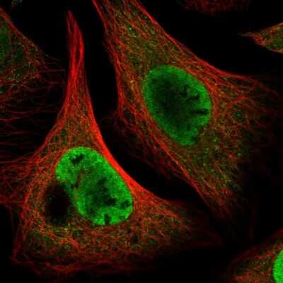 Immunocytochemistry/ Immunofluorescence: p23/PTGES3 Antibody [NBP1-85486]